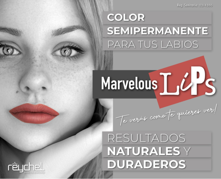 Marvellous-Lips-768x621