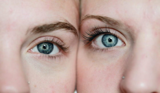CONTORNO DE OJOS CONTORNO DE OJOS